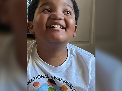 kids epilepsy