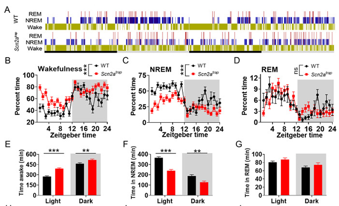 Deficiency of autism-related Scn2a gene in mice disrupts sleep patterns and circadian rhythms